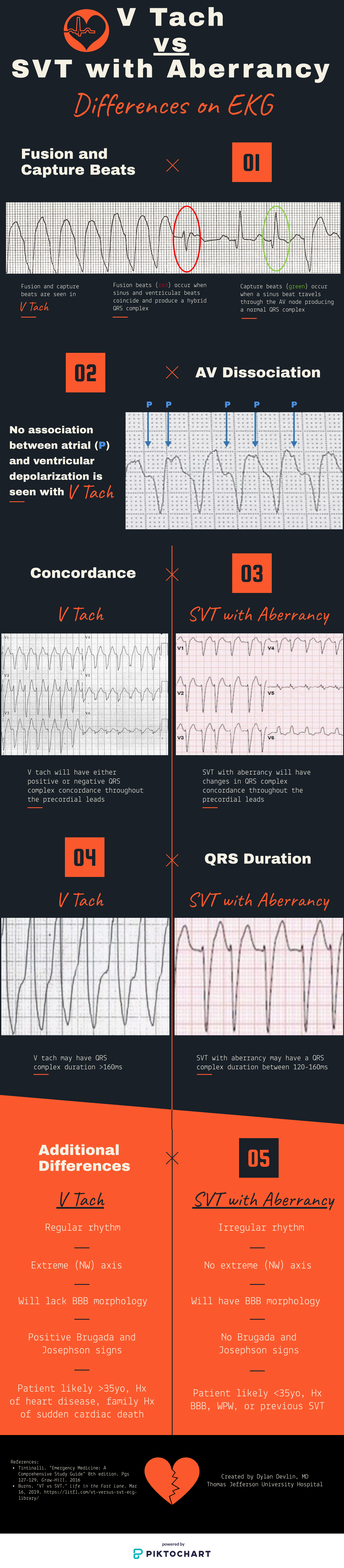 Read more about the article V Tach vs. SVT with Aberrancy