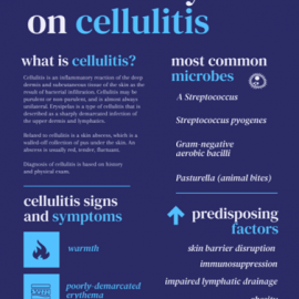 Cellulitis (Victoria DiMelis/XZhang)