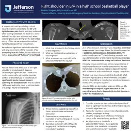 Right shoulder pain in a High School Basketball Player (Tanigawa)