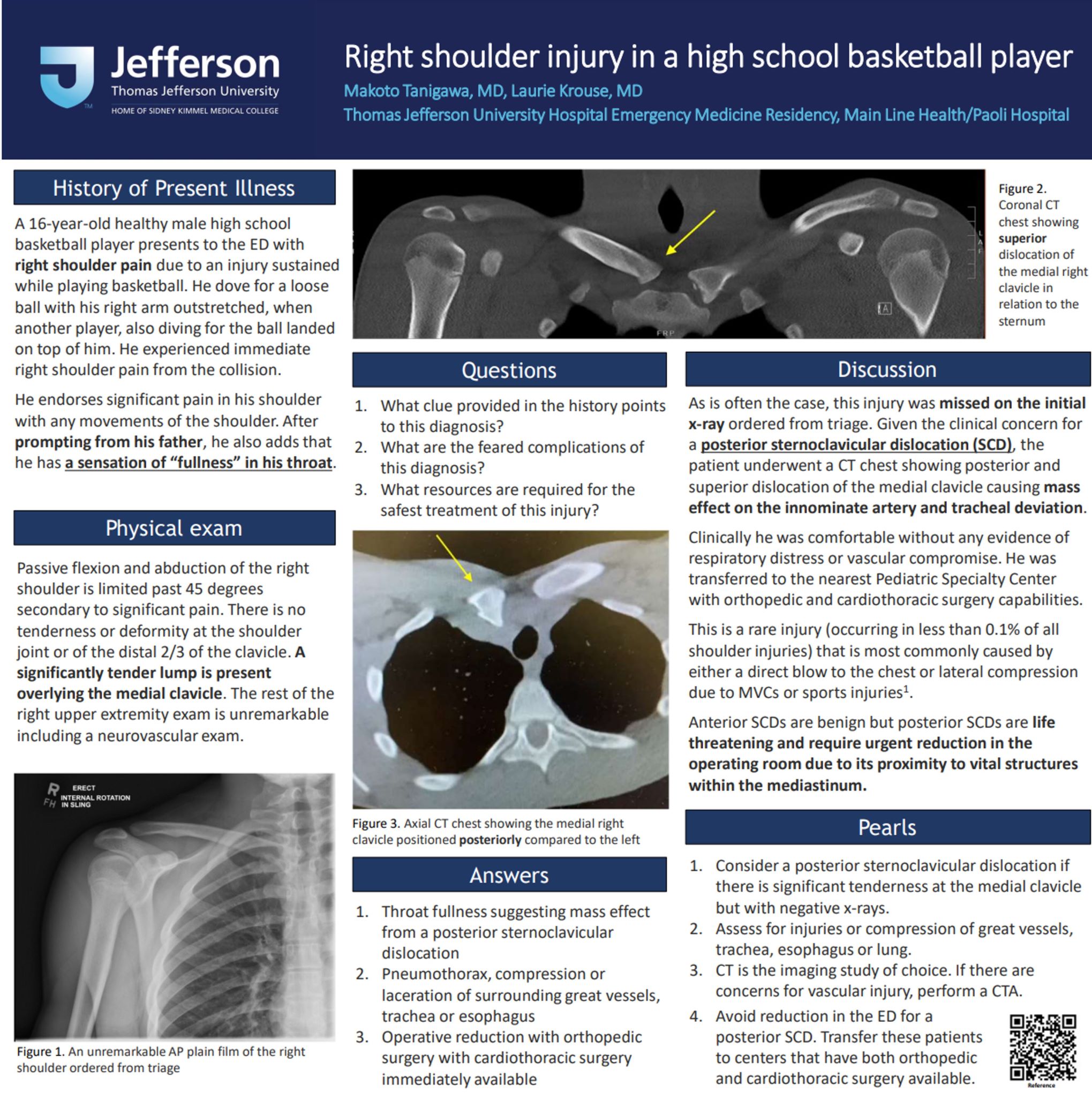 Read more about the article Right shoulder pain in a High School Basketball Player (Tanigawa)