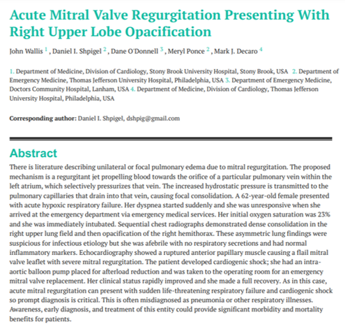 Read more about the article Acute Mitral Valve Regurgitation Presenting With Right Upper Lobe Opacification (Shpigel)