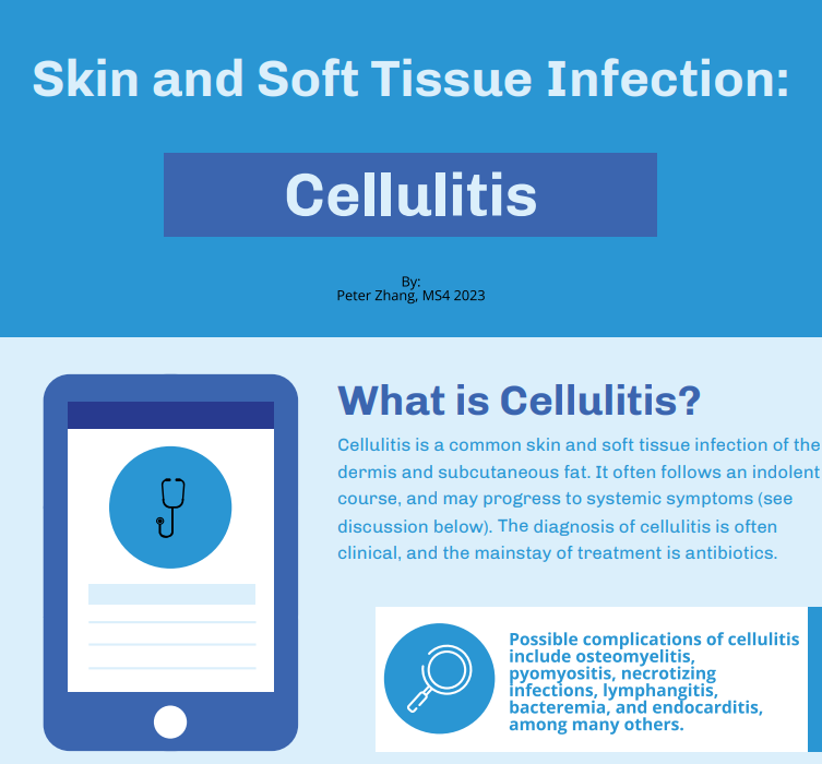 Read more about the article Cellulitis (PZhang/XZhang)